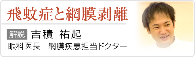 飛蚊症と網膜剥離