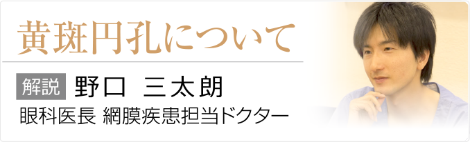 黄斑円孔について