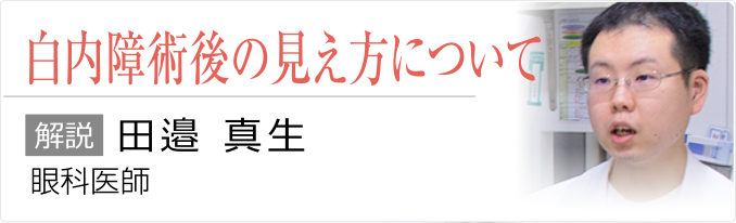 白内障術後の見え方について