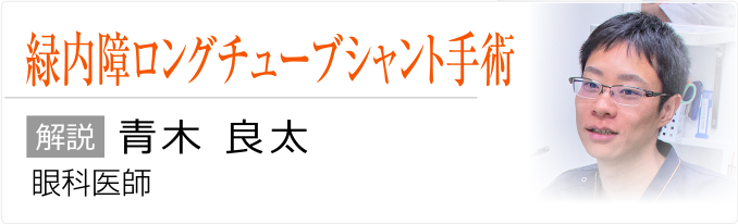 緑内障ロングチューブシャント手術について