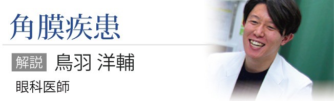 角膜疾患