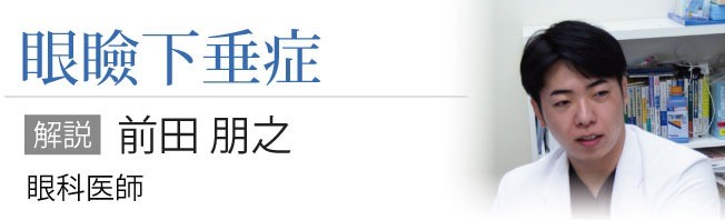 眼瞼下垂症について